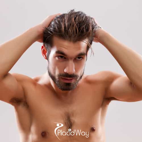 Hair Transplant in Turkey vs Ireland - Graft Prices, Hidden Fees, and Success Rates Compared for UK Men